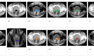 Los 100 primeros compradores se apuntan a la preventa de la próxima colección de NFT
